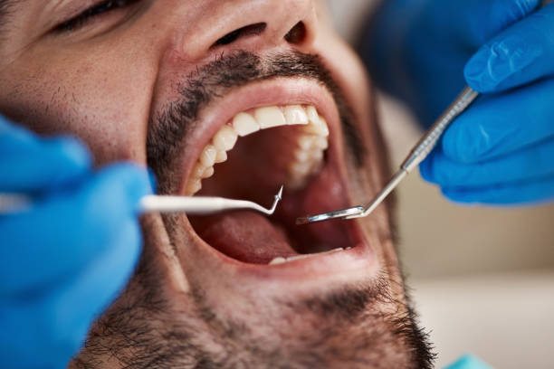 Best Emergency Gum Pain Relief  in Stapleton, AL